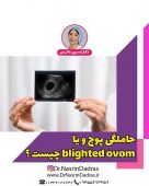 حاملگی پوچ و یا blighted ovom چیست ؟